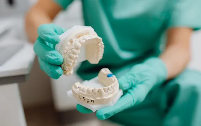 Modelli dentali in gesso in laboratorio odontotecnico
